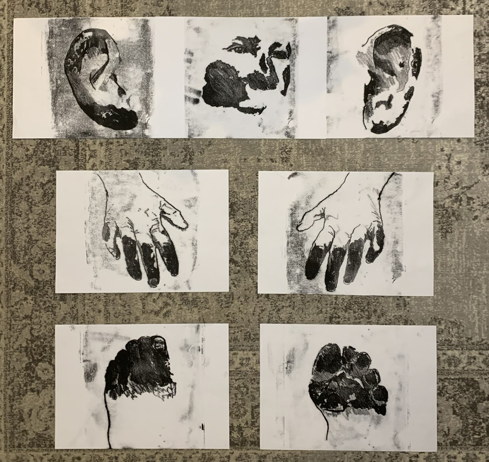 Dokumentacja siedmiu rysunków na dywanie. Rysunki przedstawiają pewne części ciała, które uległy odmrożeniu. 