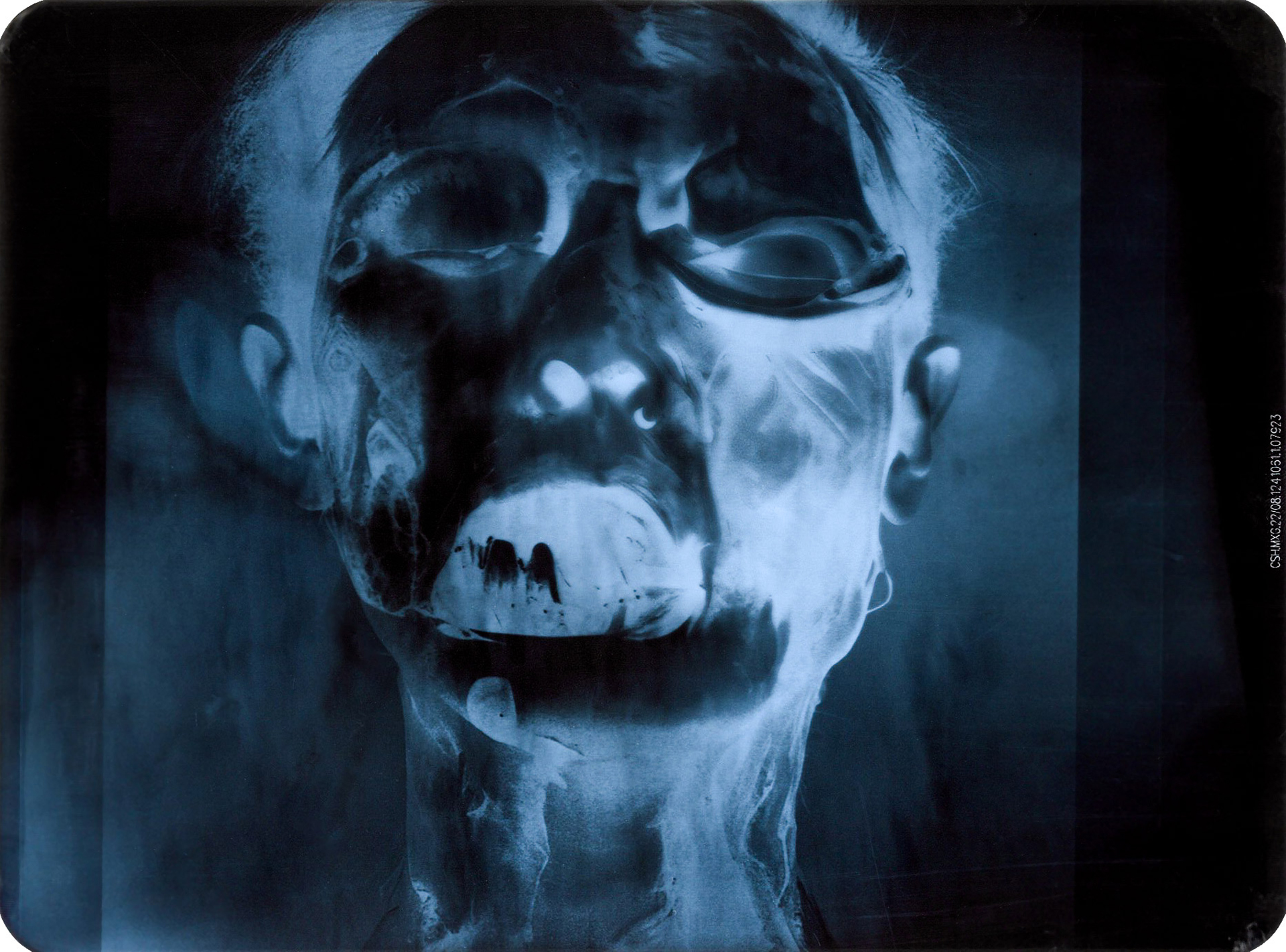 Cykl obrazów w konwencji medycznych fotografii rentgenowych, przedstawiających humanoidalne motywy o patologicznie zniekształconych głowach, czaszkach, zębach, kościach, itp.