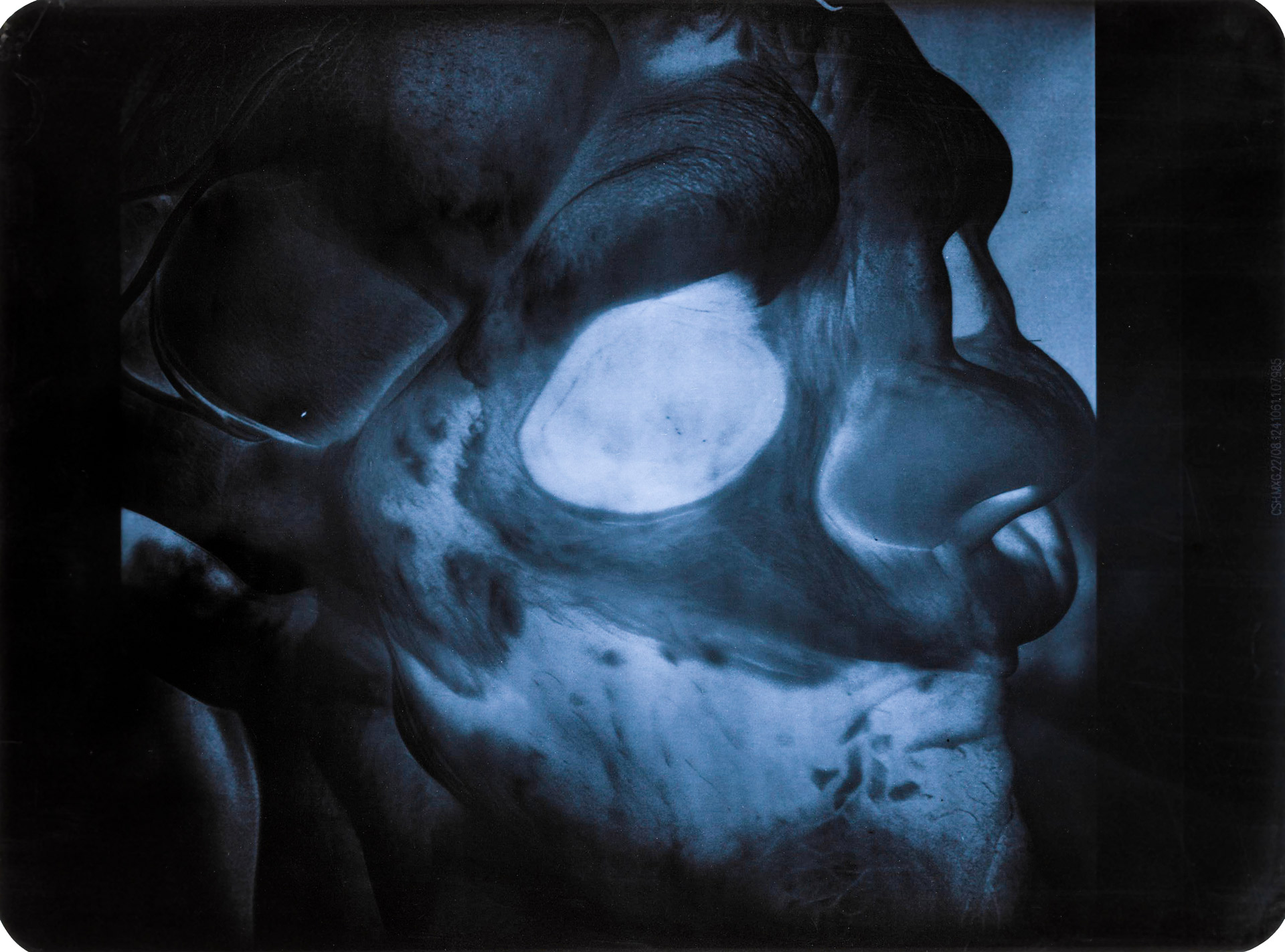 Cykl obrazów w konwencji medycznych fotografii rentgenowych, przedstawiających humanoidalne motywy o patologicznie zniekształconych głowach, czaszkach, zębach, kościach, itp.